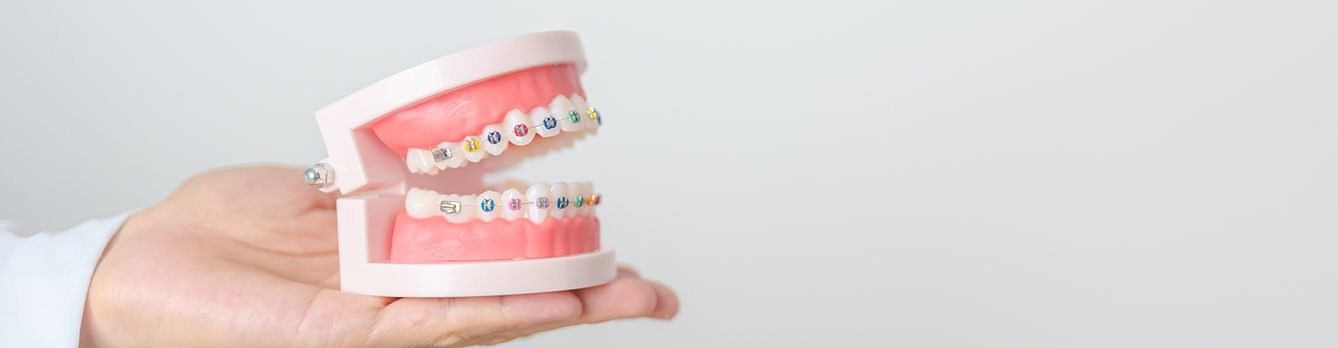 Hand holding mouth model wearing braces.